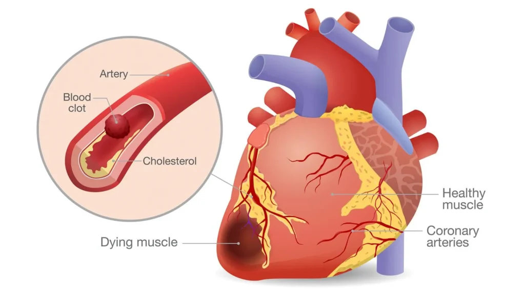 how ati diagnostic template help for heart failure