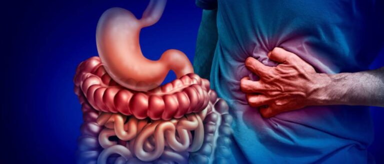 Crohn's Disease