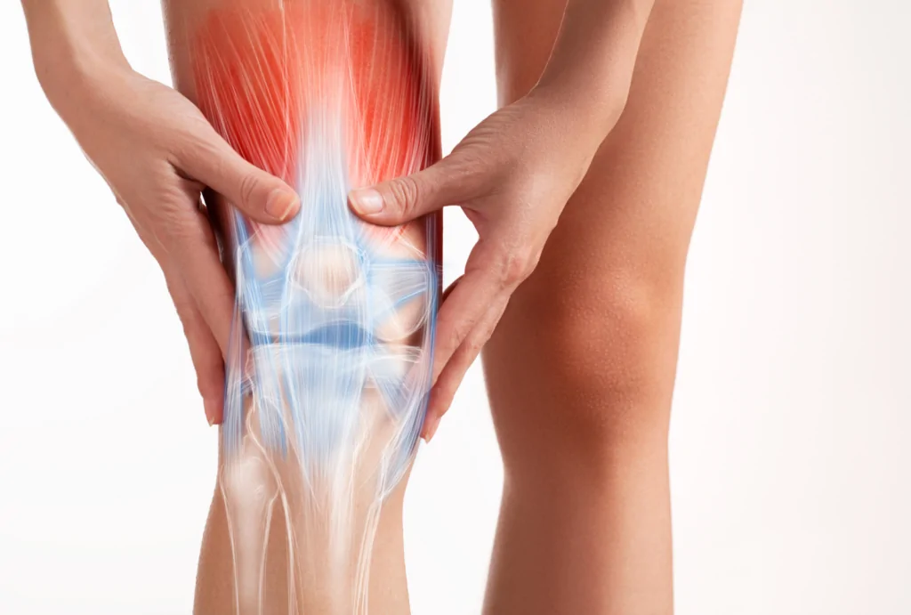 Can Sciatica Cause Knee Pain