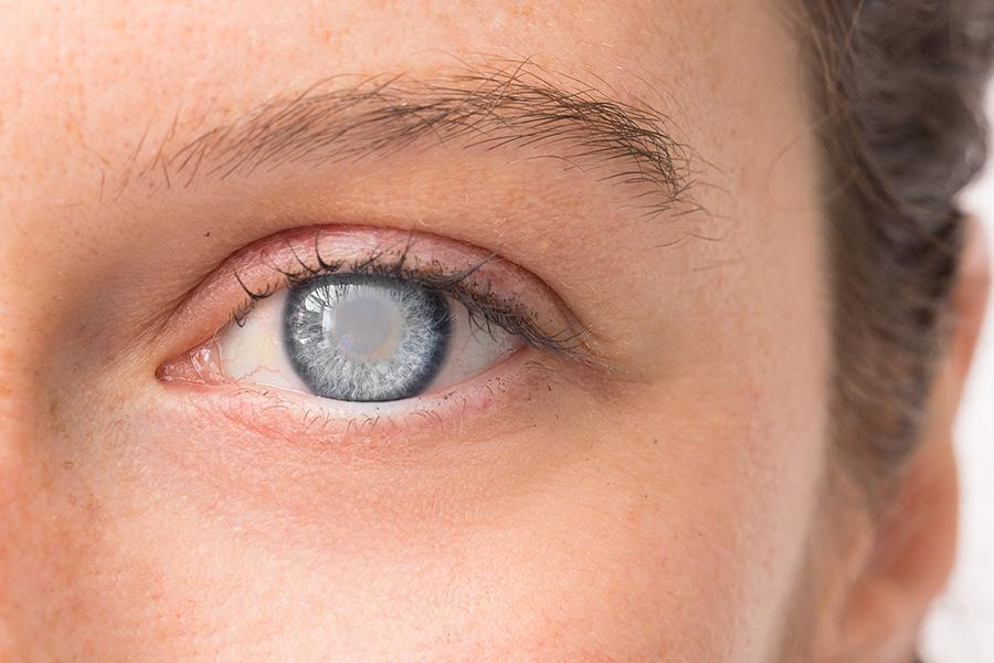 GA Eye Disease Symptoms