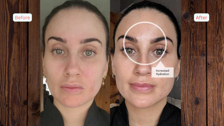 Vitamin C Serum Before and After