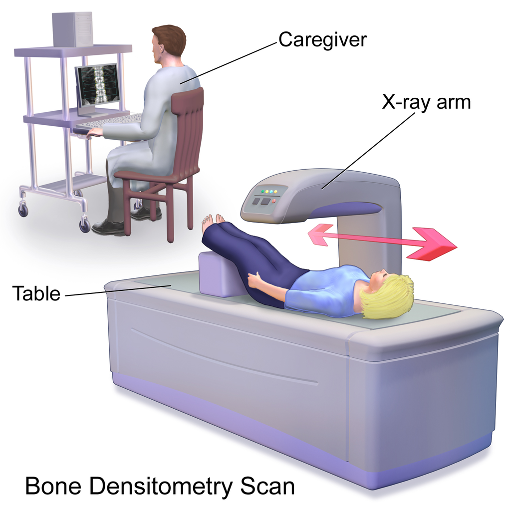 Screening for Osteoporosis ICD 10