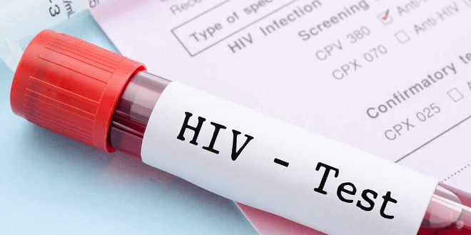 HIV Testiranje